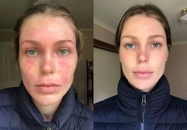 Before using MOODBUTTER