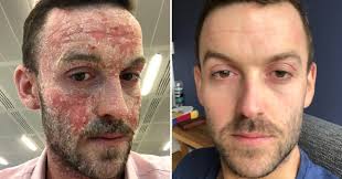 Before using MOODWASH
