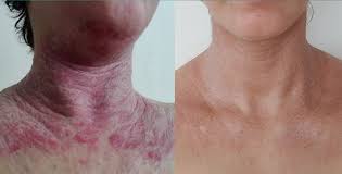 Before using MOODBUTTER