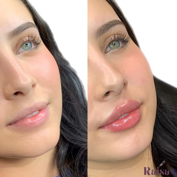 Before using LIP CARE